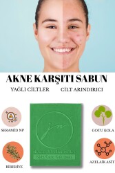 AKNE KARŞITI SERAMİD NP & AZELAİK ASİT & GOTU KOLA SABUNU 85 GR - 1